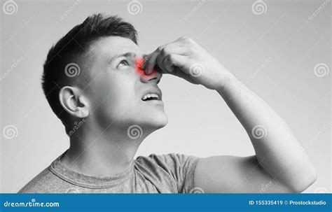 Young Man Suffering From Nose Bleeding Black And White Royalty Free