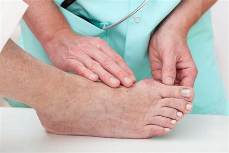 Bone Tumors Of The Feet — Podiatry Group The Foot Doctors