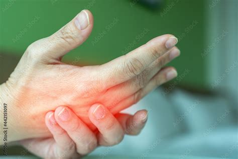 Overuse Hand Problems Womans Hand With Red Spot On Fingers As Suffer