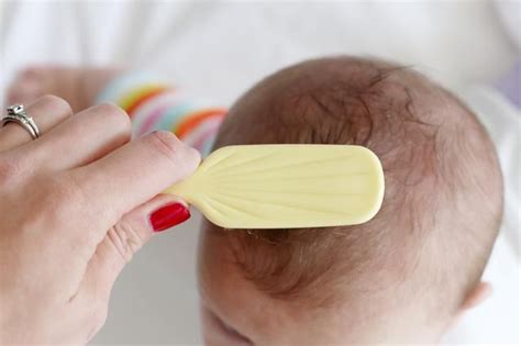 Healthfully Baby Dry Scalp Remedies Baby Dry Scalp Baby Dandruff
