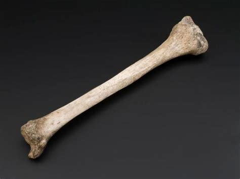 Bone Broke Posts On Archaeology Osteology And Biological Anthropology