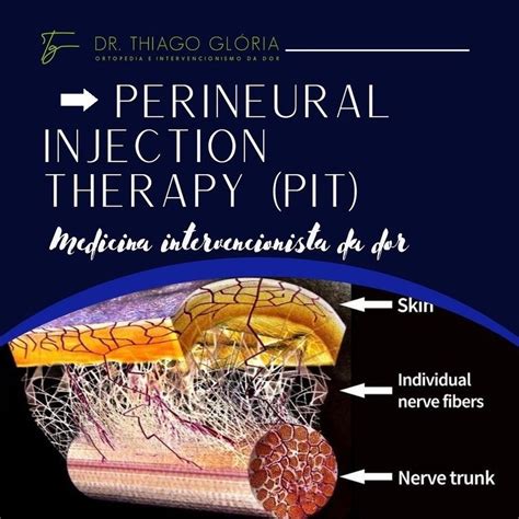 Perineural Injection Therapy Pit