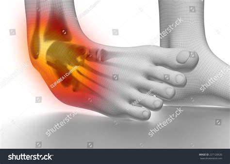 Sprained Ankle On White Stock Illustration 227120620 Shutterstock