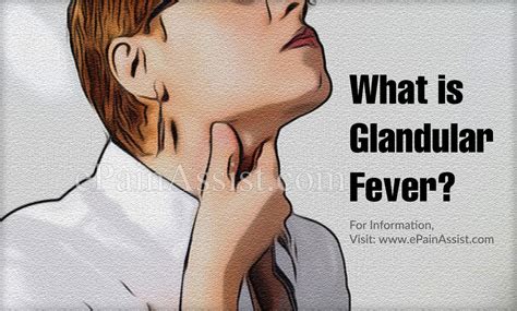 What Is Glandular Fever And How Is It Treated Causes And Symptoms Of