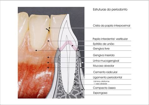 Espessamento Do Ligamento Periodontal
