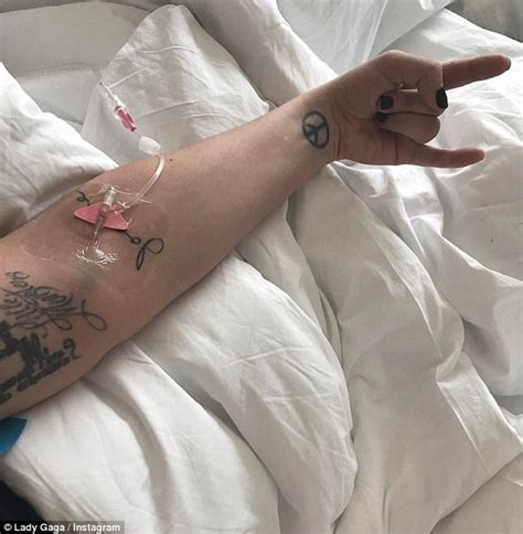 Lady Gaga Recovering From Ailment After Postponing Shows Daily Mail