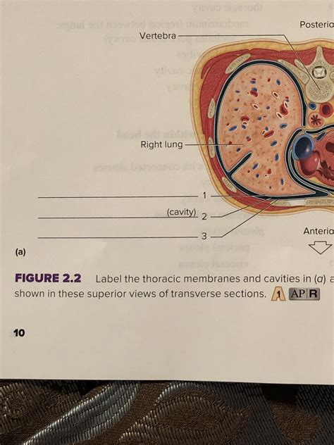 Fill in the blank. Meaning: inflammation of the stomach an | Quizlet
