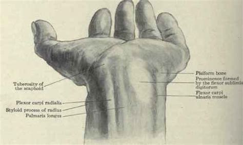 12 best images about Anatomy of Wrist on Pinterest | Medicine, Human