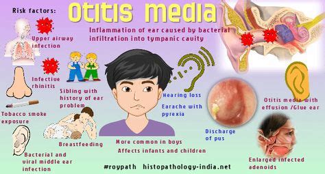 Otitis Media Is An Inflammation Of The Ear That Is Caused By Bacterial