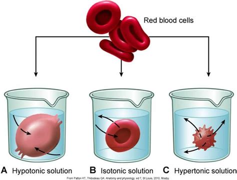 If placed in a hypotonic solution, water molecules will enter the cell, causing it to swell and burst. Alterations in Fluid Balance at University of Northern ...