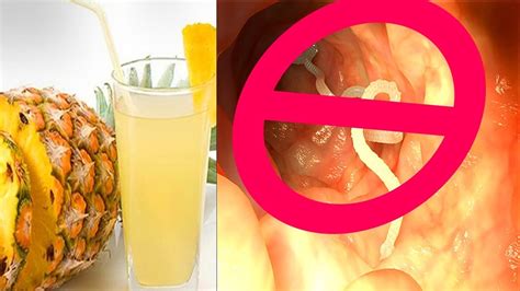 Treat Tapeworms In Humans With 4 Effective Home Remedies Youtube