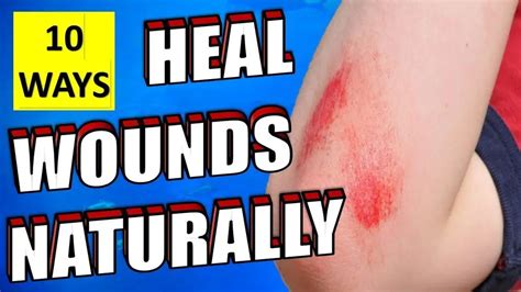 10 Natural Ways To Heal Wounds And Scrapes Fast And Quickly Epic