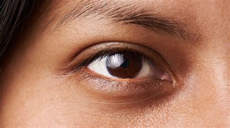 What Causes Dark Circles And How Do You Get Rid Of Them Huffpost Uk Life