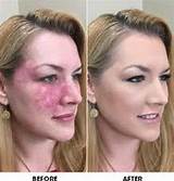 Cover Up Makeup For Face Images