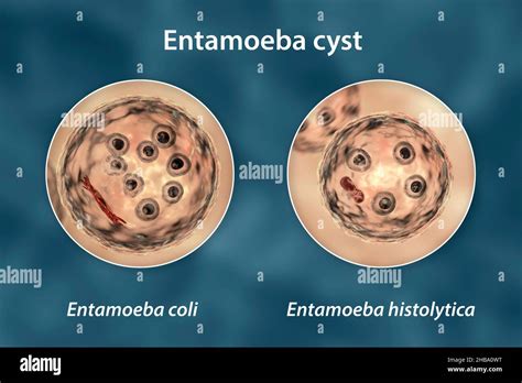 Entamoeba Coli O Que é