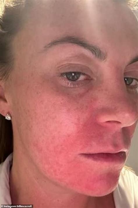 Billi Mucklow Shares Shocking Pictures Of Her Battle With A Mystery