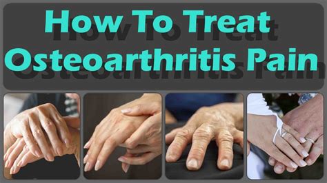 How To Prevent And Treat Osteoarthritis In The Hands And Osteoarthritis