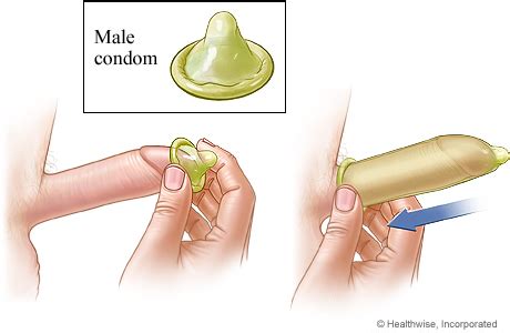 Male Condom Method Of Birth Control