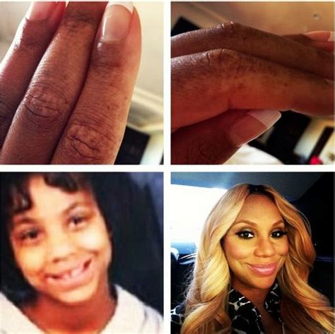 Beauty Tamar Braxton Uncovers Struggle With Vitiligo