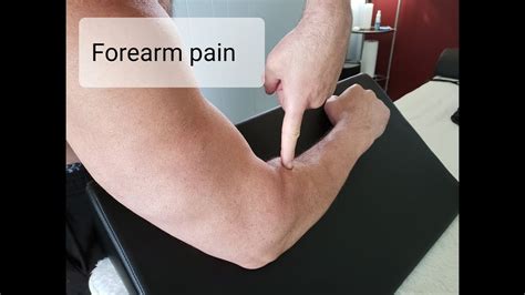 Radial Tunnel Syndrome Forearm Pain From Screwdriver Motion Youtube