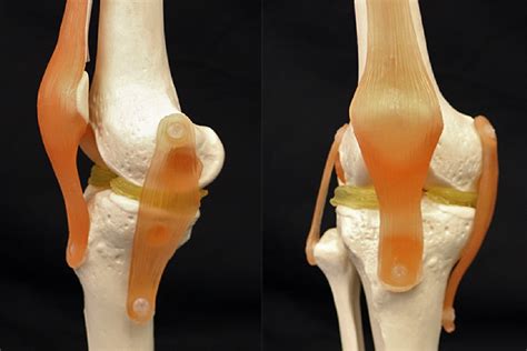 3d Printing Could Help Repair Damaged Knees With Cartilage Mimicking