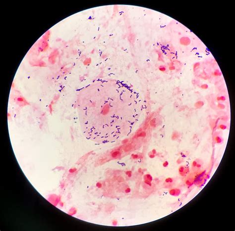 Gram Positive Bacilli On Red Background Stock Photo Image Of Hospital