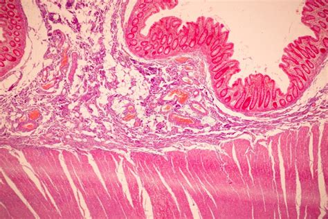 Tissue Of Small Intestine Duodenum Large Intestine Human And Stomach