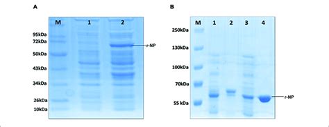 Protein concentrations were determined by the nanodrop method using the proteins peptidic molecular weight and extinction coefficient as determined by the online expasy software (protparam). (A) M: Protein molecular weight marker (Cat. # SM0661 ...