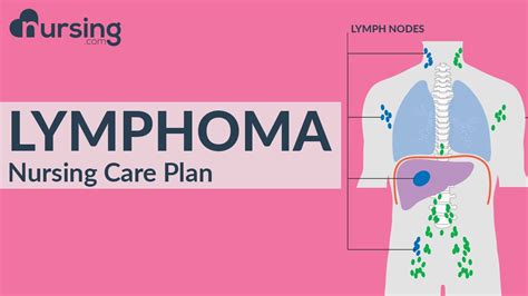 Nursing Care Plan For Lymphoma Nursing Care Plan Tutorial Youtube