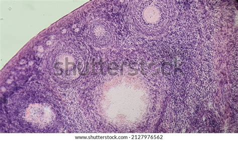 Section Mammalian Ovary Under Microscope Follicles Foto Stok 2127976562