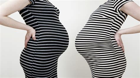 Two Pregnant Women In Striped Dresses Pre Eclampsia Sperm Donor Prenatal Yoga Future Maman