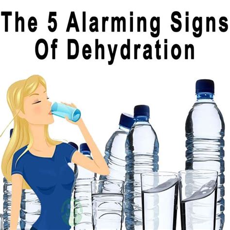 The 5 Alarming Signs Of Dehydration In 2020 Signs Of Dehydration