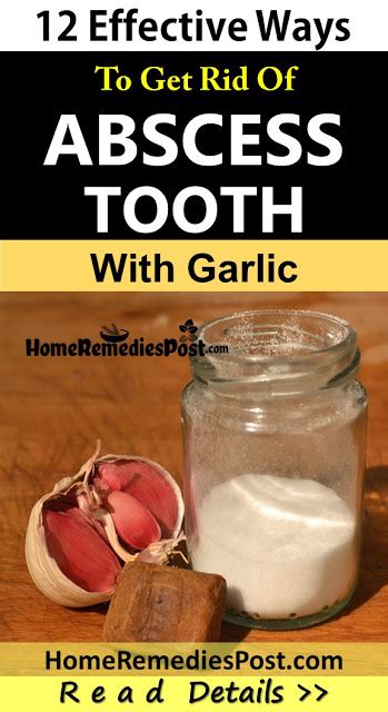 Use this solution at least three times daily. How To Use Garlic To Get Rid Of Abscess Tooth - Home ...