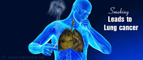 pictures of lung cancer caused by smoking xxx pics