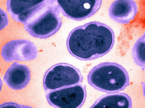 Gonorrhea — Aka The Clap — Is Excellent At Resisting Antibiotics New