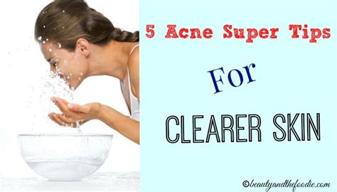 Five Acne Super Tips For Clearer Skin Beauty And The Foodie