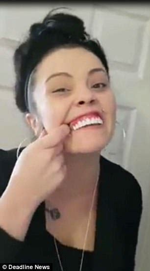 Woman Struggles To Remove £5 Veneers She Bought On Ebay Daily Mail Online