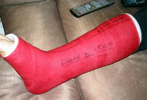 Broken Ankle Carol Levesques Blog