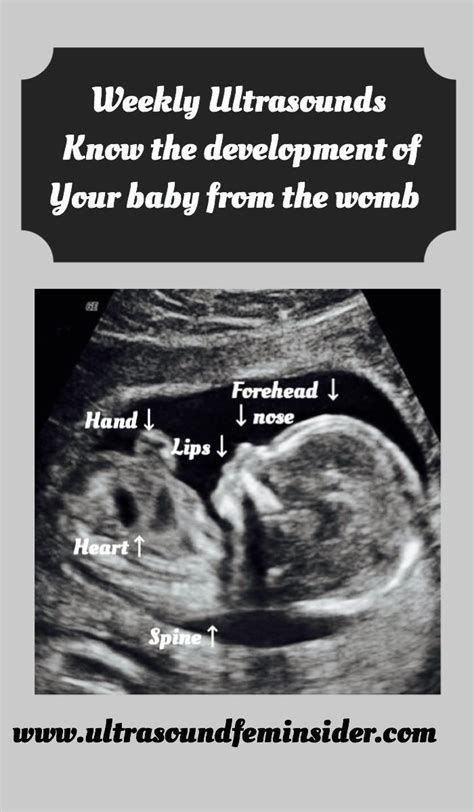 Pin on Pregnant Mamas