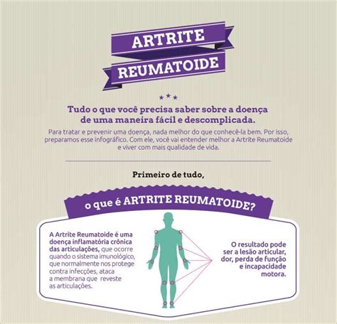 Artrite Reumatoide Pontos importantes para entender a doença Clínica