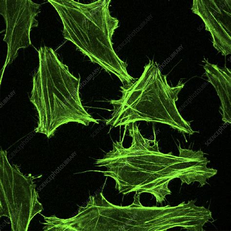 Hela Cells Light Micrograph Stock Image G4420417 Science Photo