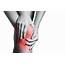 Knee Pain Copy 1  IPSC Interventional & Spine Center