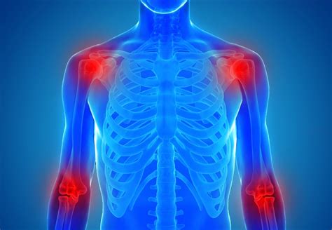Inflammation is a necessary biological process that signals our immune system to pay attention to certain tissues in the body. How To Reduce Inflammation In 9 Easy Steps