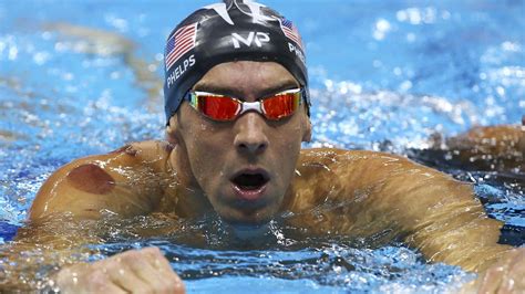 Rio 2016 Olympics Cupping Is The The Latest Unproven Therapy Olympians