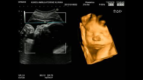 My Baby 4d Ultrasound 28 Weeks Part4 Youtube