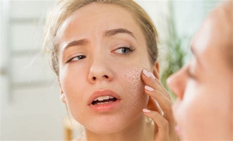 Five Reasons Why White Spots Appear On The Skin
