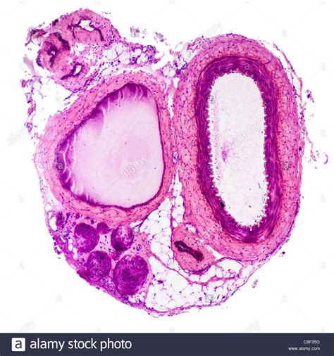 From wikimedia commons, the free media repository. Microscopic cross section of an artery and vein Stock ...
