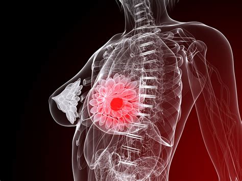 Real Time 3d Breast Cancer Screening Could Be A Possibility With New