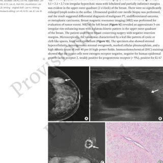 Metastases presenting as scalp masses 3 years post-surgery ...
