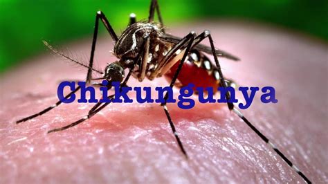 El Chikungunya Youtube